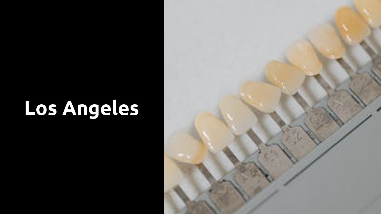 Los Angeles